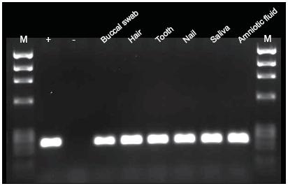  Scientific Phusion人源样本直接PCR试剂盒-价格-厂家-供应商-世尔科技