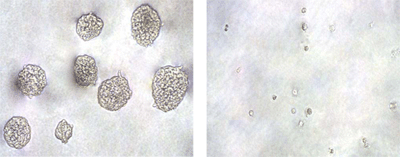 肿瘤细胞敏感性分析—CytoSelect™ In Vitro Tumor Sensitivity Assay