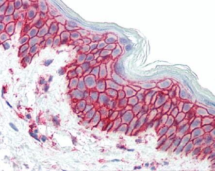 免疫组化试验抗体选择及常用染色方法