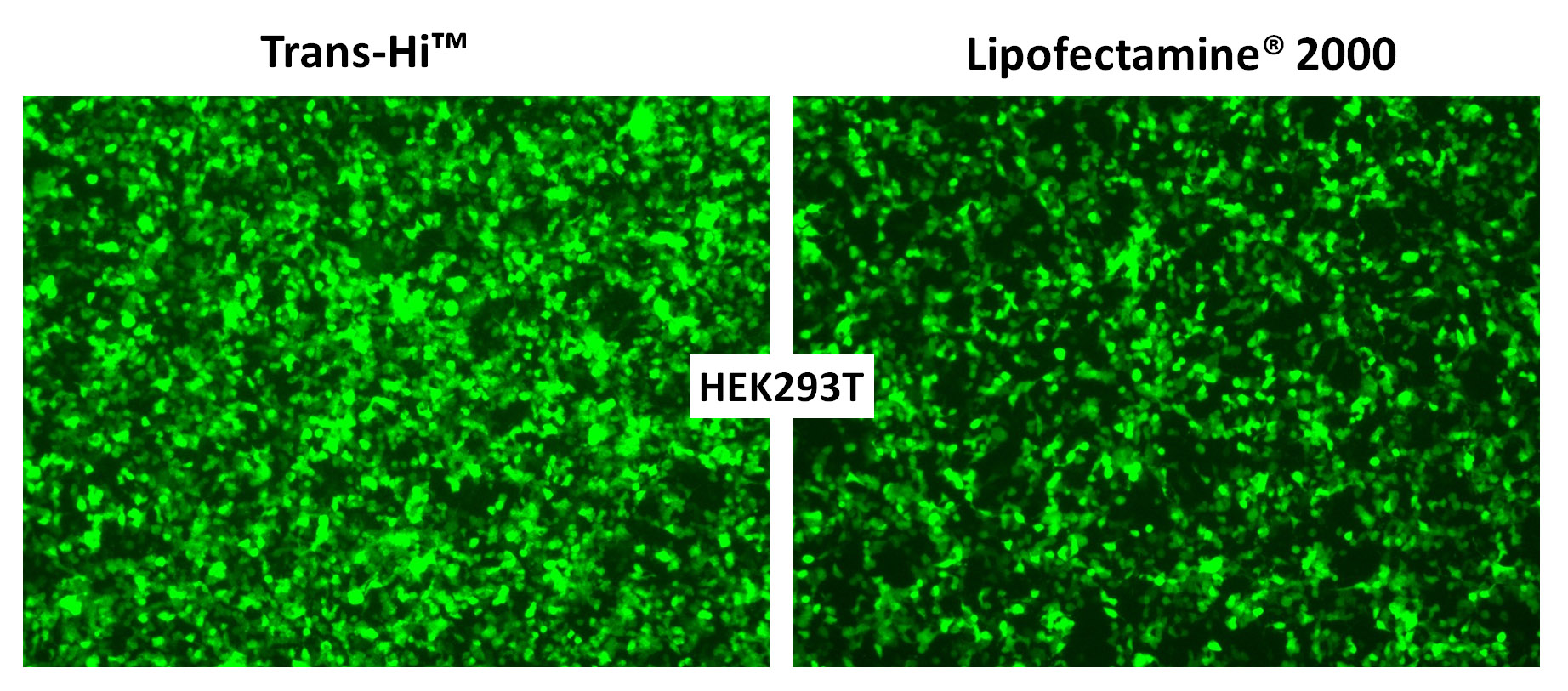 trans-Hi–体外转染试剂（Trans-Hi&trade; – In vitro Transfection F90101TH