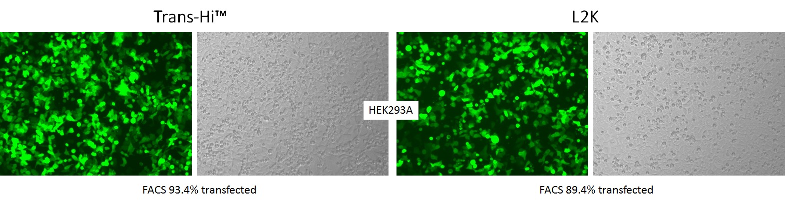 trans-Hi–体外转染试剂（Trans-Hi&trade; – In vitro Transfection F90101TH