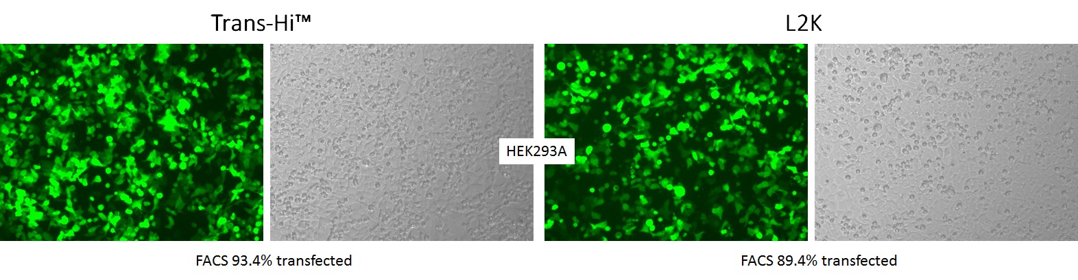 trans-Hi–体外转染试剂（Trans-Hi&trade; – In vitro Transfection F90101TH