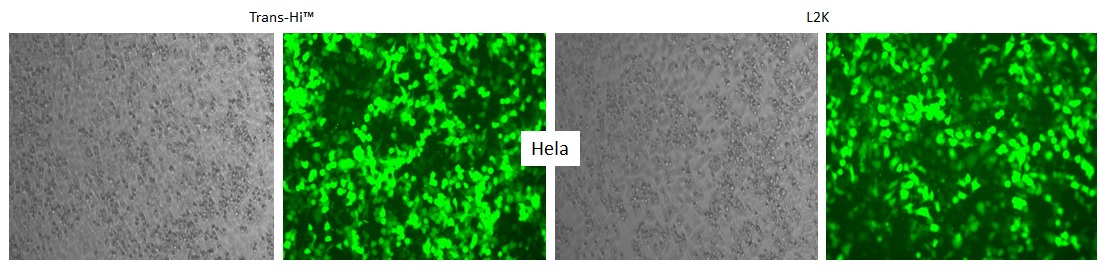 trans-Hi–体外转染试剂（Trans-Hi&trade; – In vitro Transfection F90101TH