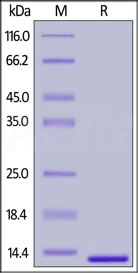 人类 β2-微球蛋白 / B2M 蛋白，His 标签B2M-H5225-1mg