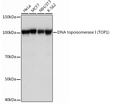 DNA 拓扑异构酶 I (TOP-1) 兔单克隆抗体介绍