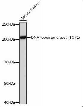 DNA 拓扑异构酶 I (TOP-1) 兔单克隆抗体介绍