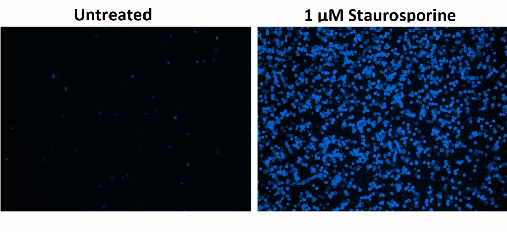Cell Meter 磷脂酰丝氨酸凋亡检测试剂盒 蓝色荧光,适合微孔板检测