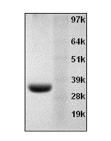 重组Annexin V 蛋白 CAS 136107-94-3