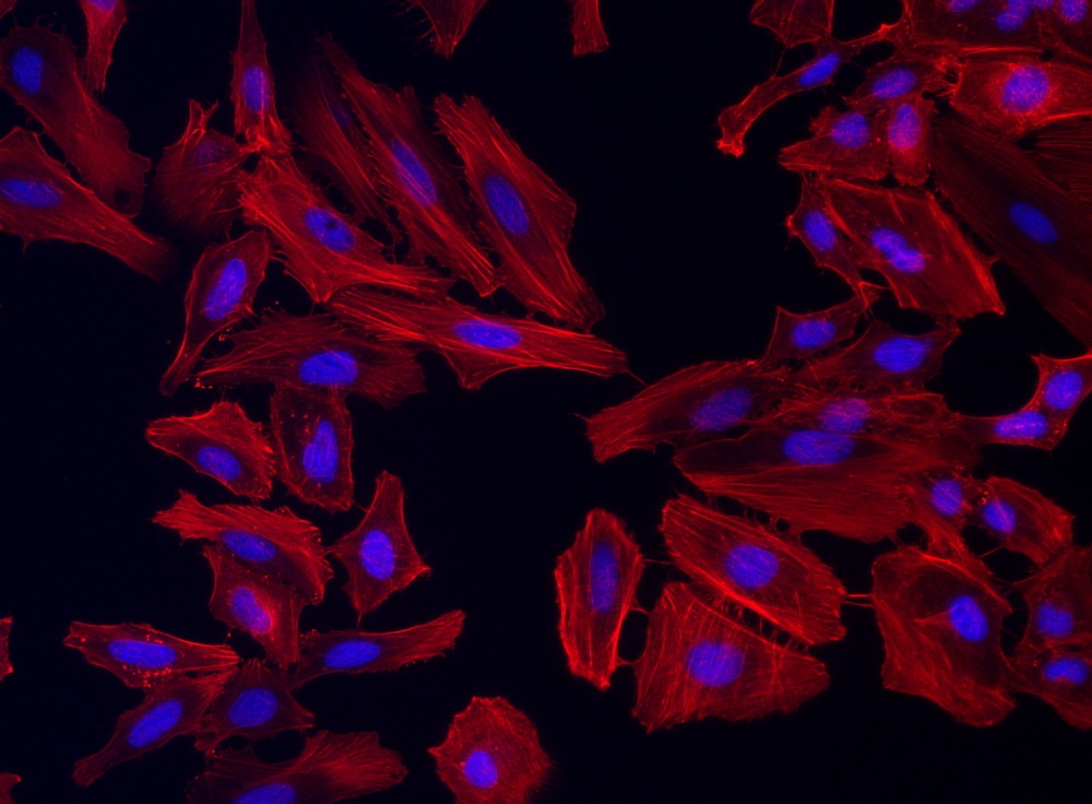 Cell Navigator F-肌动蛋白（F-Actin）标记试剂盒 橙色荧光