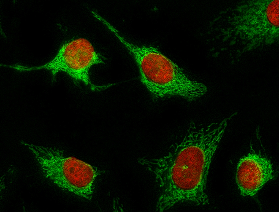 核红 LCS1 活细胞染料